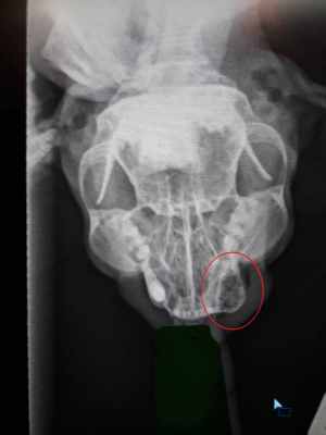 воспаление на ретгене.jpg